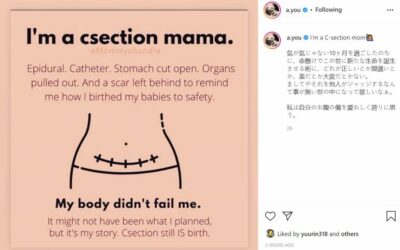 Ayumi Hamasaki reveals that she had a C-section